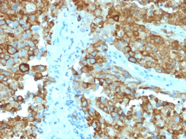 gp100/Melanosome/PMEL17/SILV Antibody in Immunohistochemistry (Paraffin) (IHC (P))