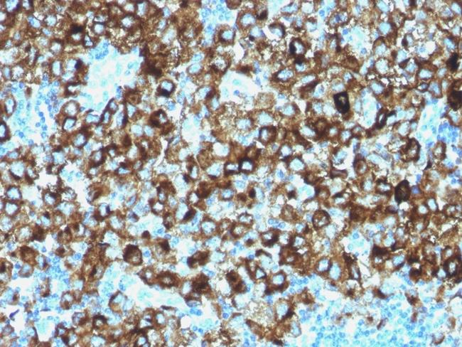 gp100/Melanosome/PMEL17/SILV (Melanoma Marker) Antibody in Immunohistochemistry (Paraffin) (IHC (P))