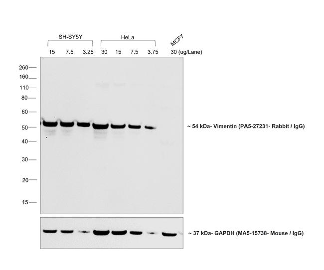 Rabbit IgG (H+L) Secondary Antibody in Western Blot (WB)