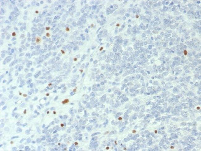 BRG1/SMARCA4 Antibody in Immunohistochemistry (Paraffin) (IHC (P))