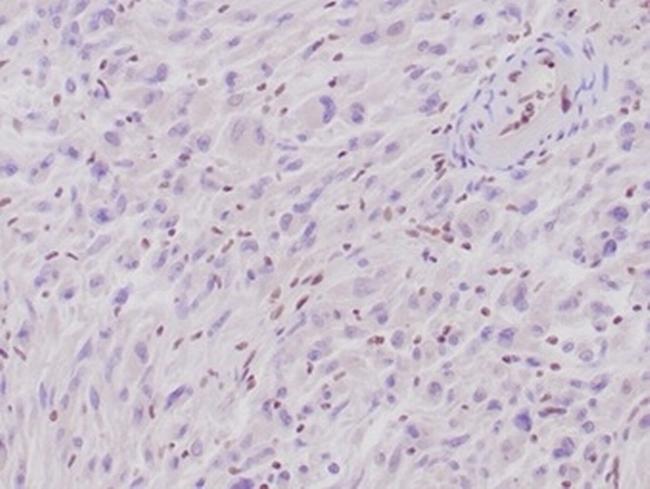 Integrase interactor 1 (INI-1)/SNF5/SMARCB1 Antibody in Immunohistochemistry (Paraffin) (IHC (P))