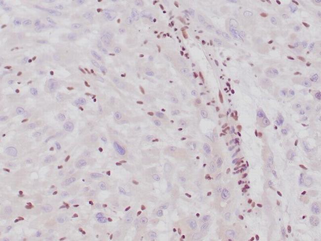 Integrase interactor 1 (INI-1)/SNF5/SMARCB1 Antibody in Immunohistochemistry (Paraffin) (IHC (P))