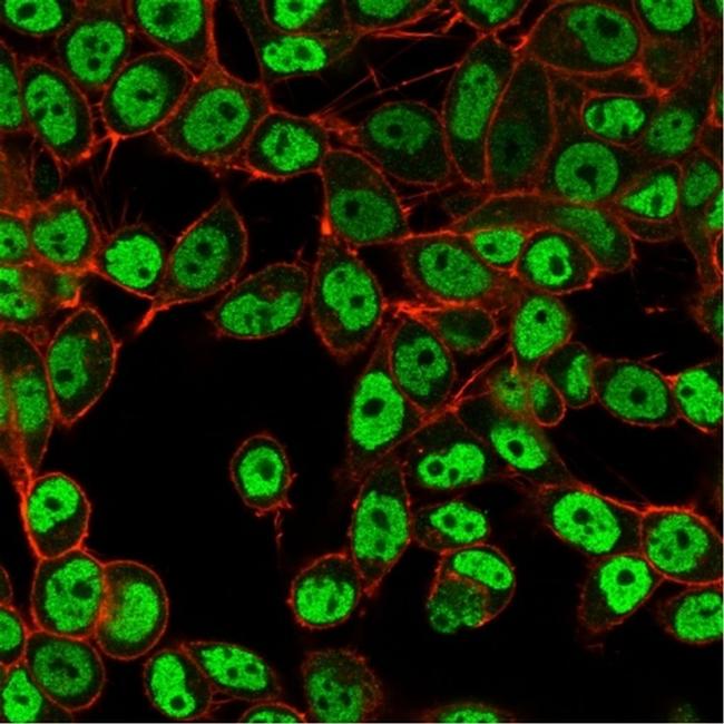 SMARCC1/BAF155 Antibody in Immunocytochemistry (ICC/IF)