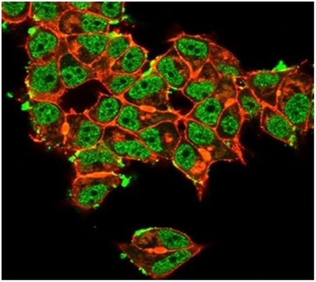 Superoxide Dismutase 1 (SOD1) (Antioxidant Enzyme) Antibody in Immunocytochemistry (ICC/IF)