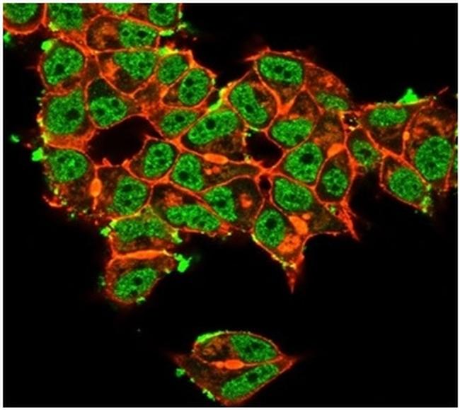 Superoxide Dismutase 1 (SOD1) (Antioxidant Enzyme) Antibody in Immunocytochemistry (ICC/IF)