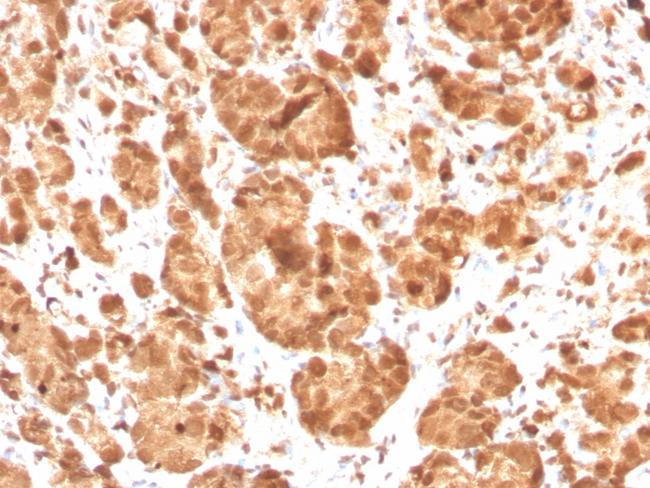 Superoxide Dismutase 1 (SOD1) (Antioxidant Enzyme) Antibody in Immunohistochemistry (Paraffin) (IHC (P))