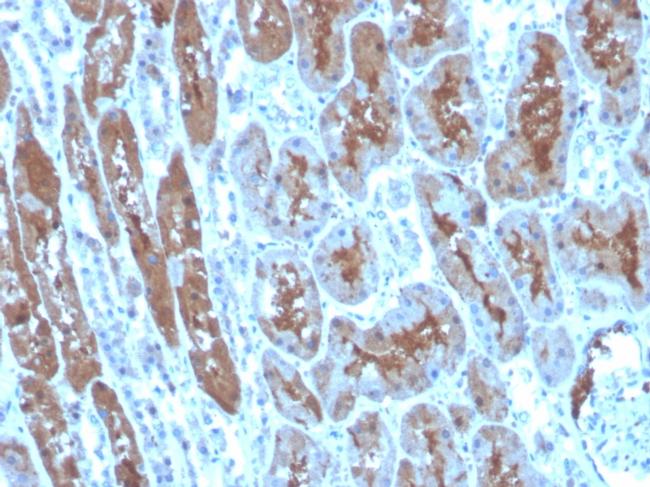 Superoxide Dismutase 1 (SOD1) (Antioxidant Enzyme) Antibody in Immunohistochemistry (Paraffin) (IHC (P))