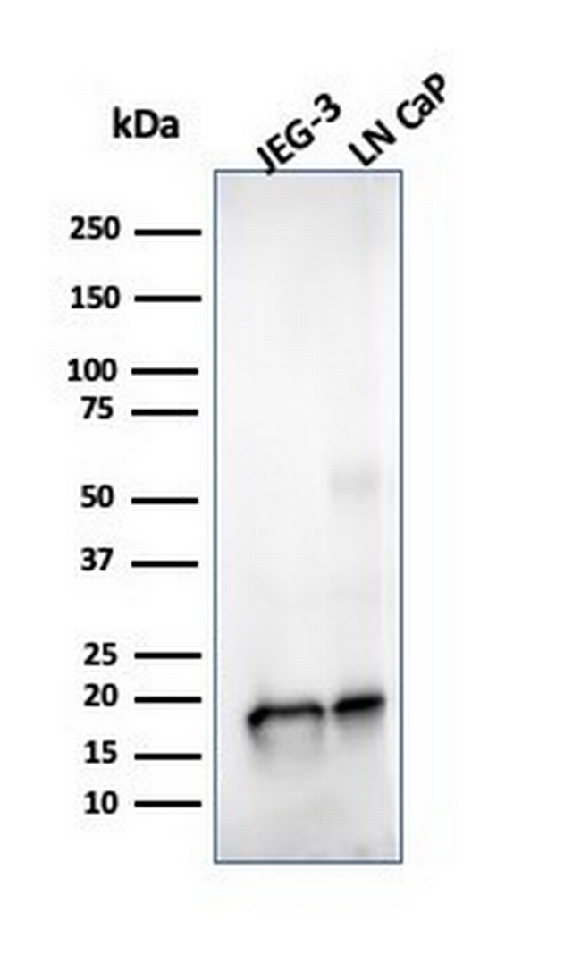 Superoxide Dismutase 1 (SOD1) (Antioxidant Enzyme) Antibody in Western Blot (WB)