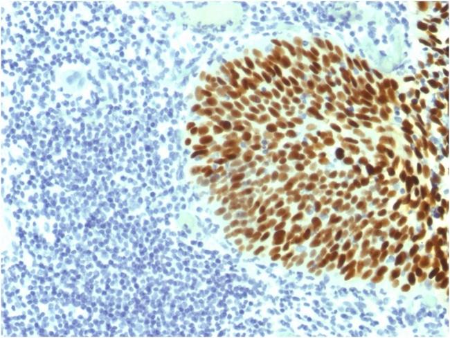 SOX2 (Embryonic Stem CellMarker) Antibody in Immunohistochemistry (Paraffin) (IHC (P))