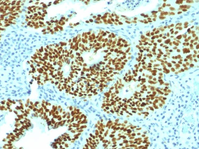 SOX2 (Embryonic Stem Cell Marker) Antibody in Immunohistochemistry (Paraffin) (IHC (P))