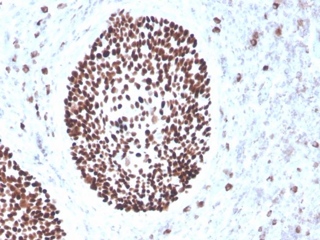 SOX2 (Embryonic Stem Cell Marker) Antibody in Immunohistochemistry (Paraffin) (IHC (P))