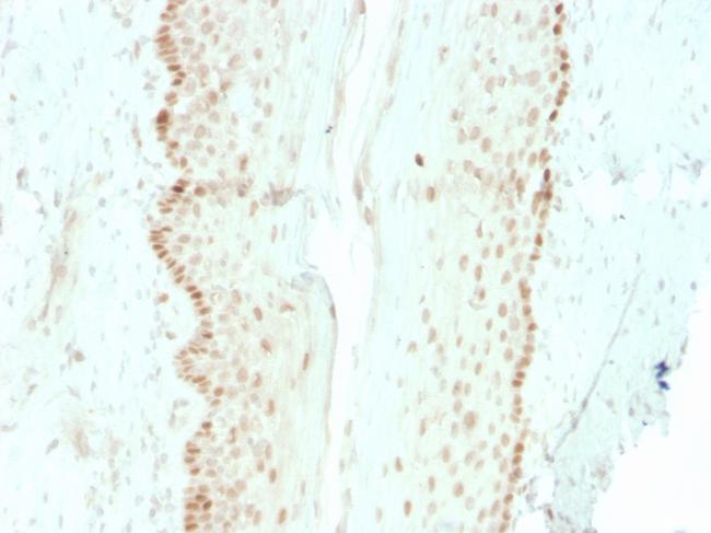 SOX2 (Embryonic Stem Cell Marker) Antibody in Immunohistochemistry (Paraffin) (IHC (P))