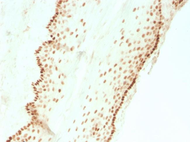 SOX2 (Embryonic Stem Cell Marker) Antibody in Immunohistochemistry (Paraffin) (IHC (P))