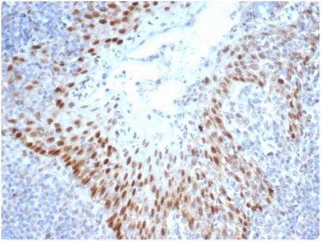 SOX2 (Embryonic Stem Cell Marker) Antibody in Immunohistochemistry (Paraffin) (IHC (P))