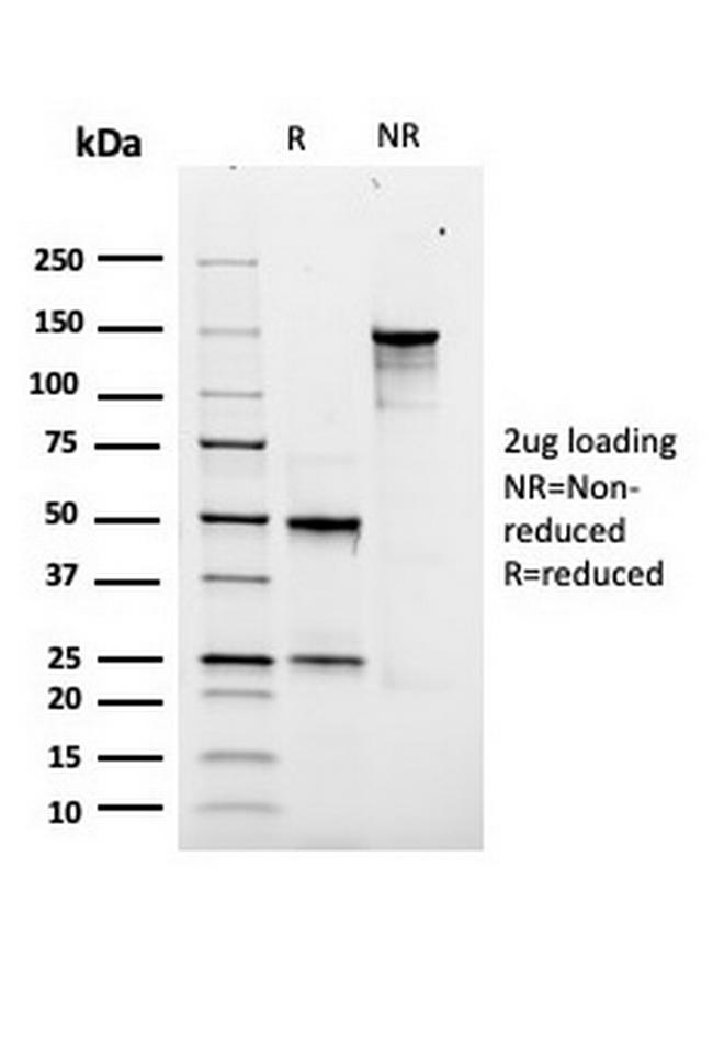 SOX9/SRY-box 9 Antibody in SDS-PAGE (SDS-PAGE)