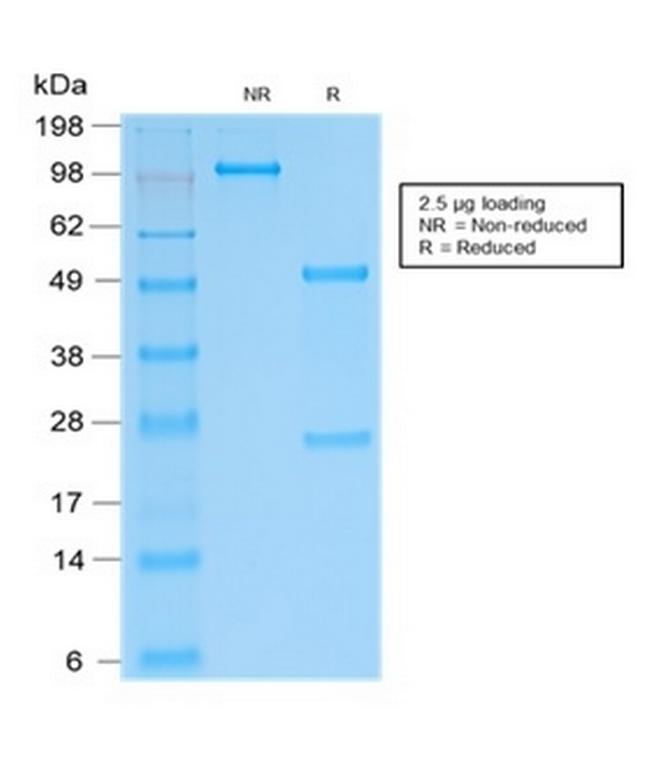 SOX9/SRY-box 9 Antibody in SDS-PAGE (SDS-PAGE)