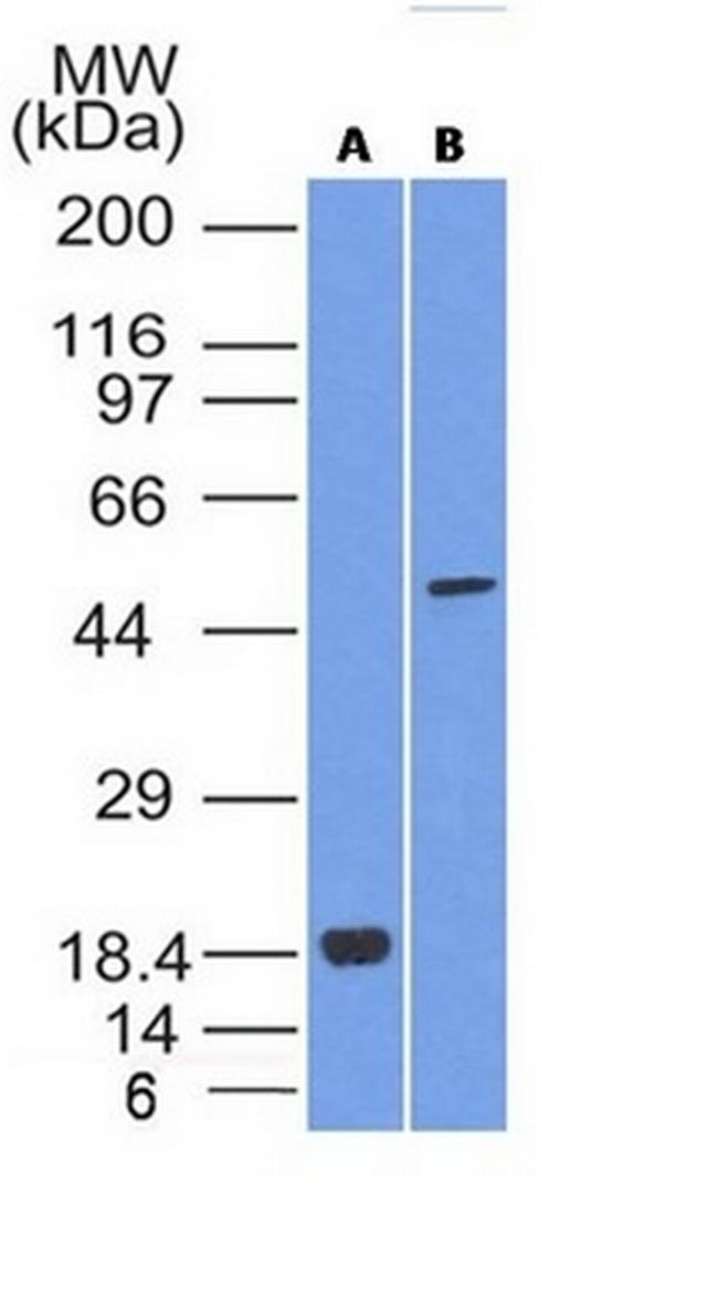 SOX10 (Melanoma Marker) Antibody in Western Blot (WB)