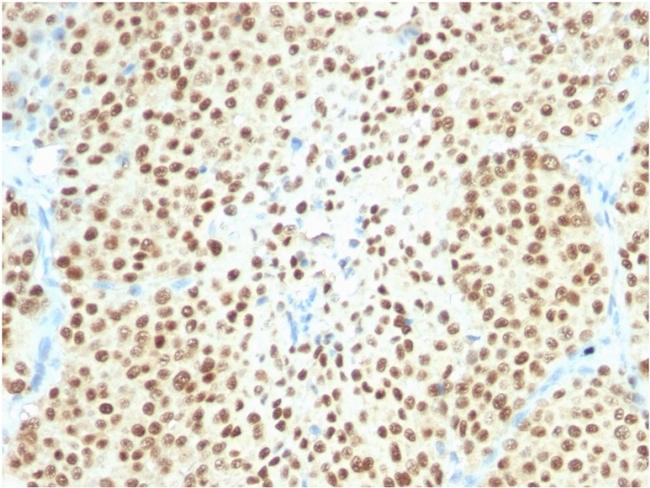 SOX10 Antibody in Immunohistochemistry (Paraffin) (IHC (P))