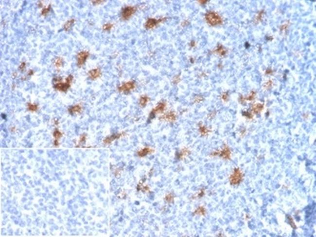 SPARC/Osteonectin Antibody in Immunohistochemistry (Paraffin) (IHC (P))