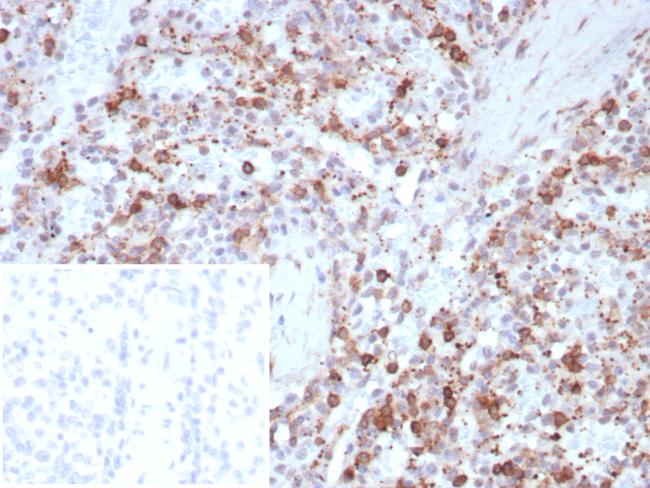 SPARC/Osteonectin Antibody in Immunohistochemistry (Paraffin) (IHC (P))