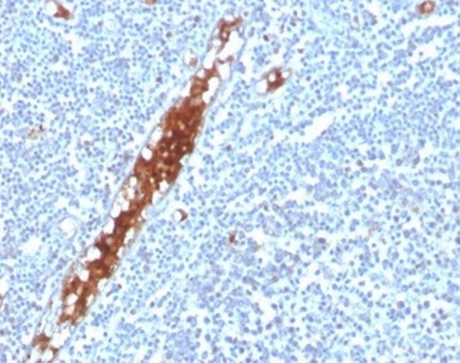 SPARC/Osteonectin Antibody in Immunohistochemistry (Paraffin) (IHC (P))