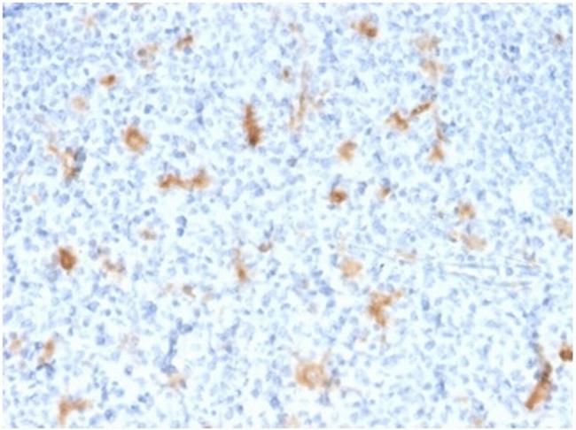 SPARC/Osteonectin Antibody in Immunohistochemistry (Paraffin) (IHC (P))