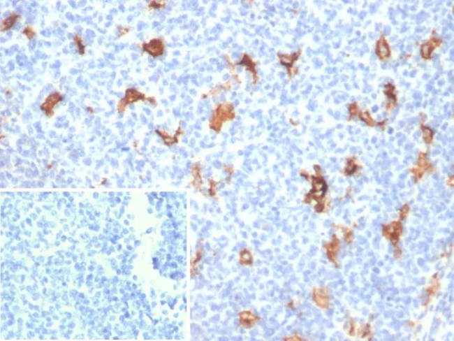 SPARC/Osteonectin Antibody in Immunohistochemistry (Paraffin) (IHC (P))