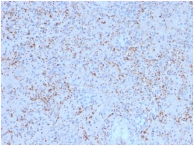 SPARC/Osteonectin Antibody in Immunohistochemistry (Paraffin) (IHC (P))