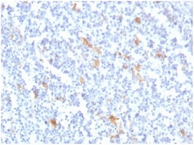 SPARC/Osteonectin Antibody in Immunohistochemistry (Paraffin) (IHC (P))