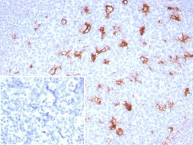 SPARC/Osteonectin Antibody in Immunohistochemistry (Paraffin) (IHC (P))