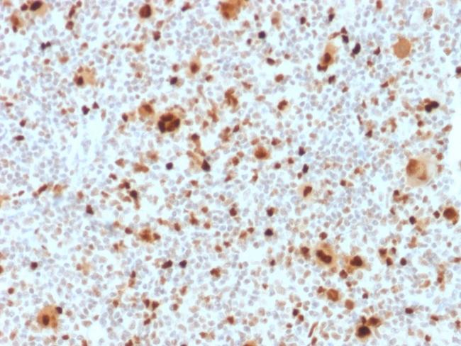 PU.1 (SPI-1) (B-Cell Marker) Antibody in Immunohistochemistry (Paraffin) (IHC (P))