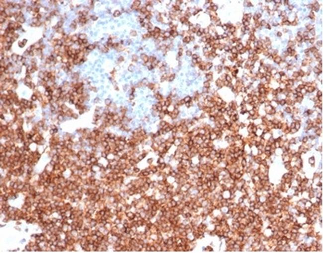 CD43 (T-Cell Marker) Antibody in Immunohistochemistry (Paraffin) (IHC (P))