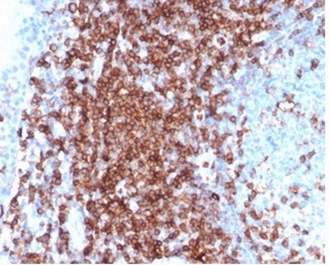 CD43 (T-Cell Marker) Antibody in Immunohistochemistry (Paraffin) (IHC (P))