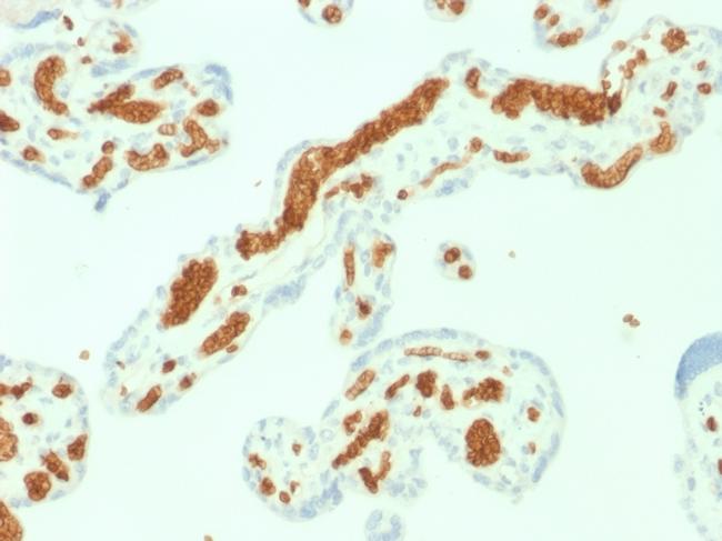 Spectrin Alpha 1 Antibody in Immunohistochemistry (Paraffin) (IHC (P))