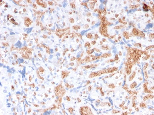 Spectrin Alpha 1 (Erythrocyte Marker) Antibody in Immunohistochemistry (Paraffin) (IHC (P))