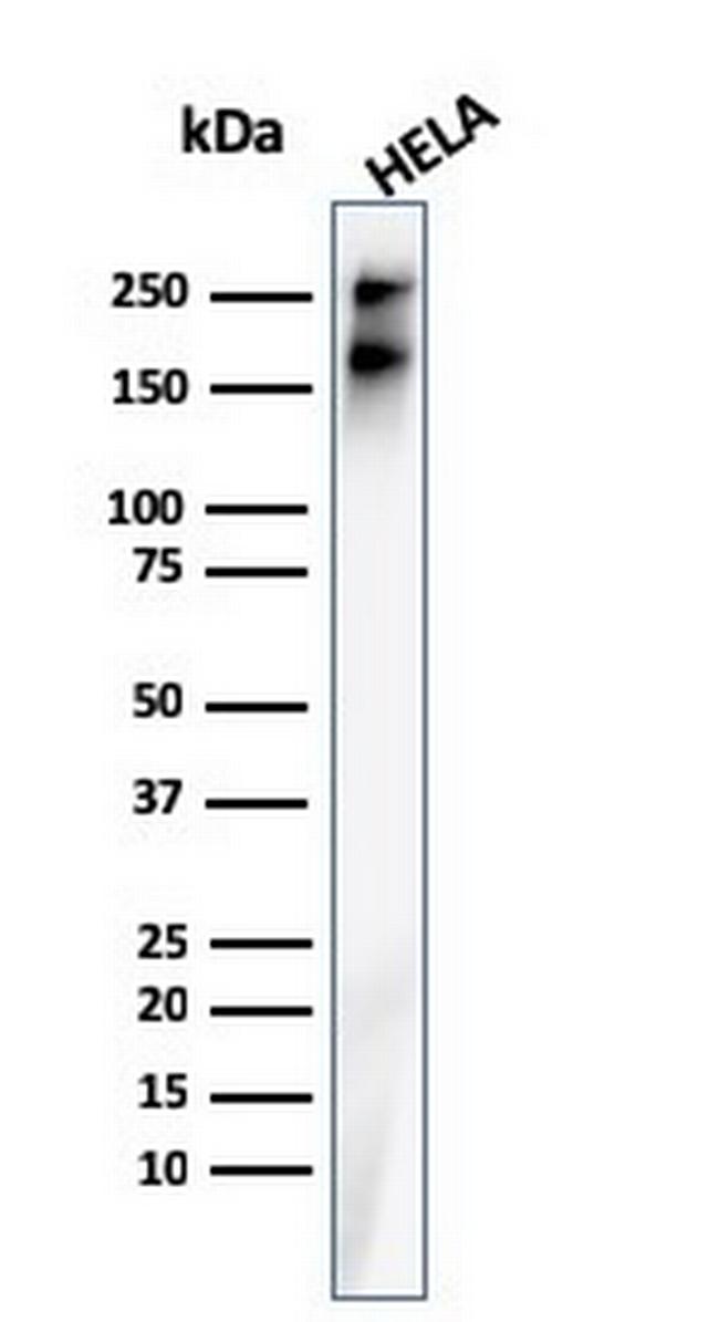 Spectrin beta III (SPTBN2) Antibody in Western Blot (WB)