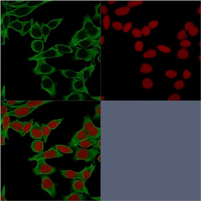 Spectrin beta III (SPTBN2) Antibody in Immunocytochemistry (ICC/IF)