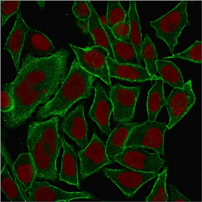 Spectrin beta III (SPTBN2) Antibody in Immunocytochemistry (ICC/IF)