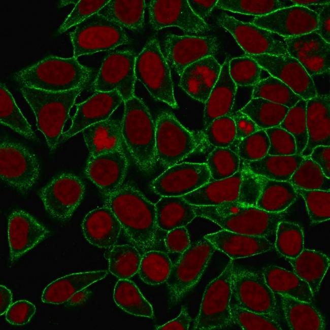 Spectrin beta III (SPTBN2) Antibody in Immunocytochemistry (ICC/IF)