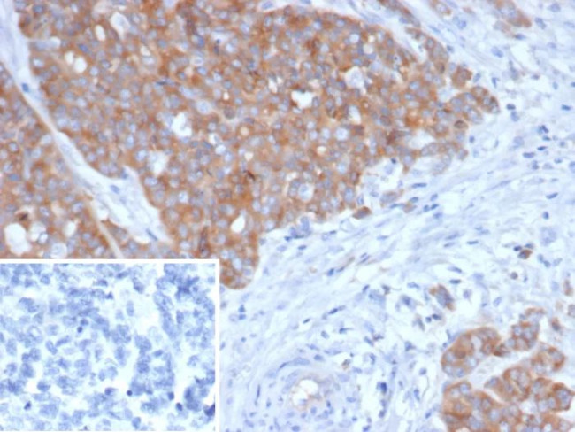 BRAF Antibody in Immunohistochemistry (Paraffin) (IHC (P))