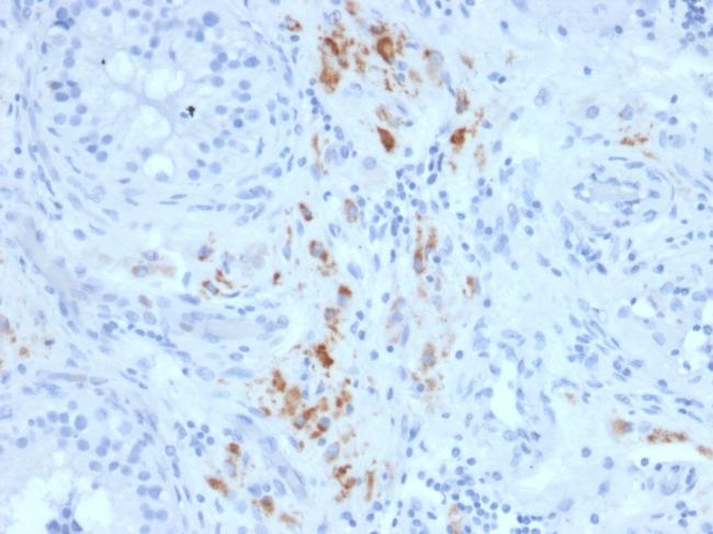 StAR (Steroidogenic Acute Regulator) Antibody in Immunohistochemistry (Paraffin) (IHC (P))