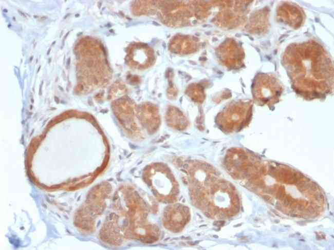 STAT5B Antibody in Immunohistochemistry (Paraffin) (IHC (P))