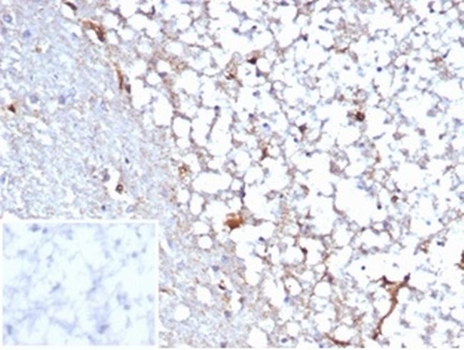 STAT6 (Solitary Fibrous Tumor Marker) Antibody in Immunohistochemistry (Paraffin) (IHC (P))