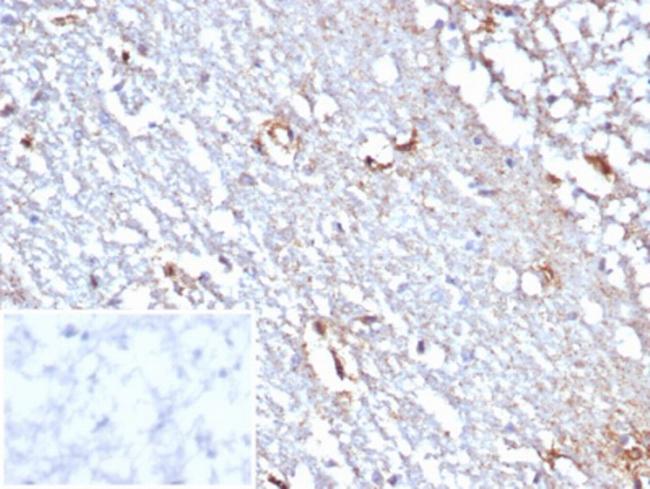 STAT6 (Solitary Fibrous Tumor Marker) Antibody in Immunohistochemistry (Paraffin) (IHC (P))