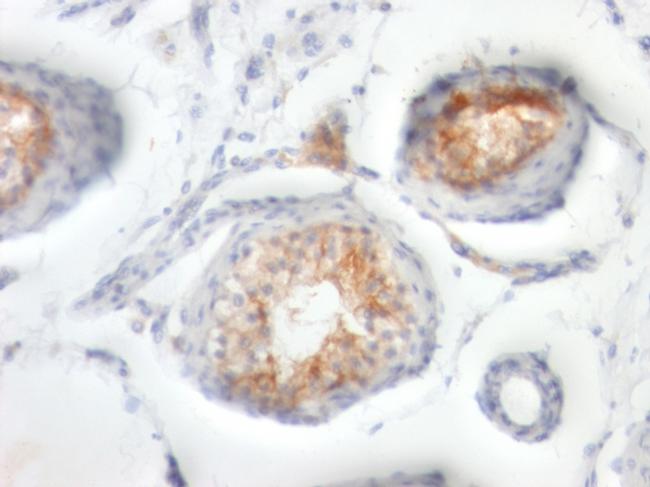 CD147/EMMPRIN/Neurothelin Antibody in Immunohistochemistry (Paraffin) (IHC (P))