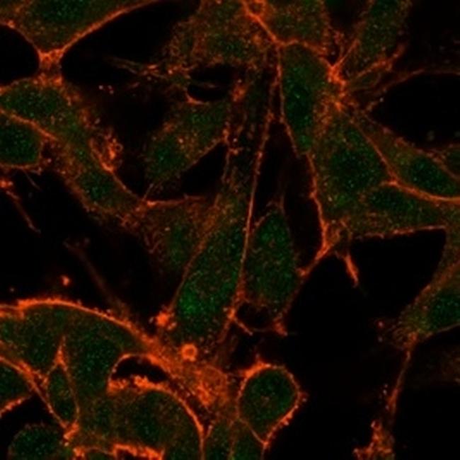 MED22 (Transcription Factor) Antibody in Immunocytochemistry (ICC/IF)