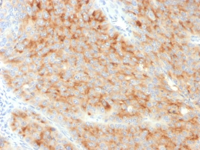 Synaptophysin Antibody in Immunohistochemistry (Paraffin) (IHC (P))