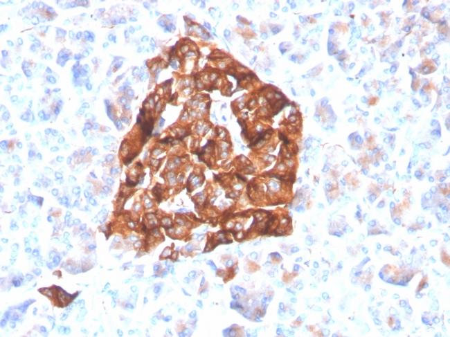 Synaptophysin Antibody in Immunohistochemistry (Paraffin) (IHC (P))