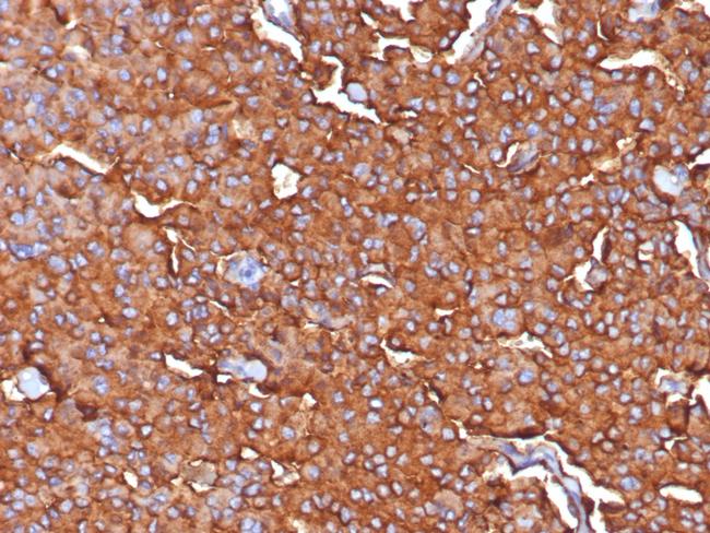 Synaptophysin (Neuroendocrine Marker) Antibody in Immunohistochemistry (Paraffin) (IHC (P))