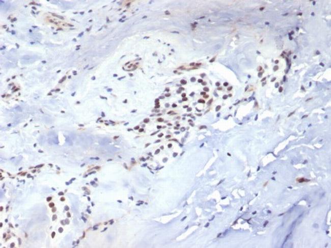 TBXT/T-box transcription factor T/Brachyury Antibody in Immunohistochemistry (Paraffin) (IHC (P))